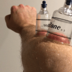 A Quick Fix to Hand, Forearm, and Elbow Pain (Video)
