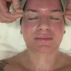 Before & After Facial Rejuvenation Cupping + Benefits